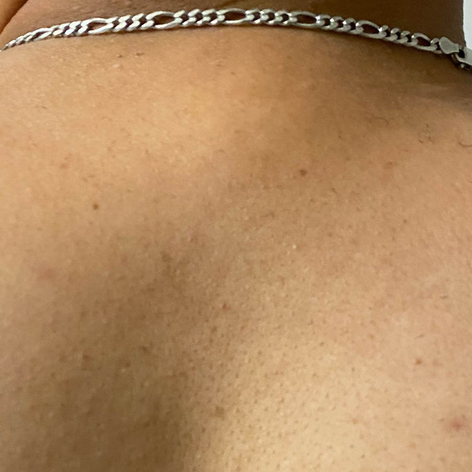 Before image