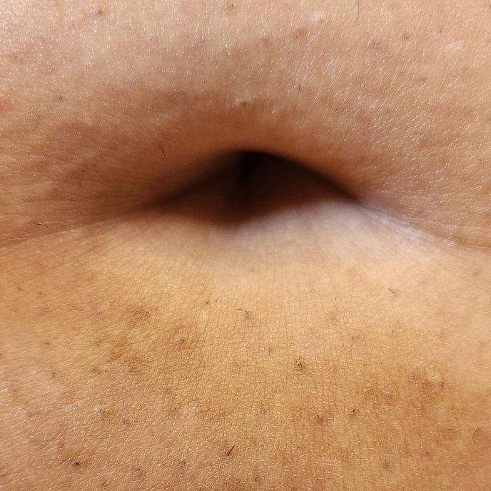 After image