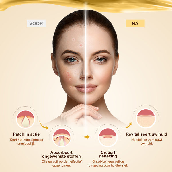 Dermaé pimple patch