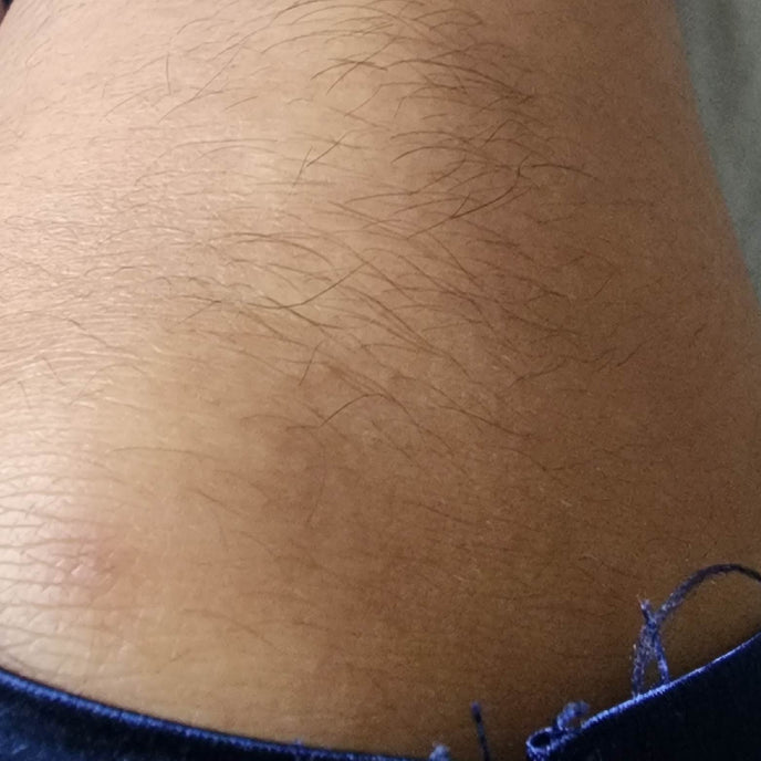 Before image