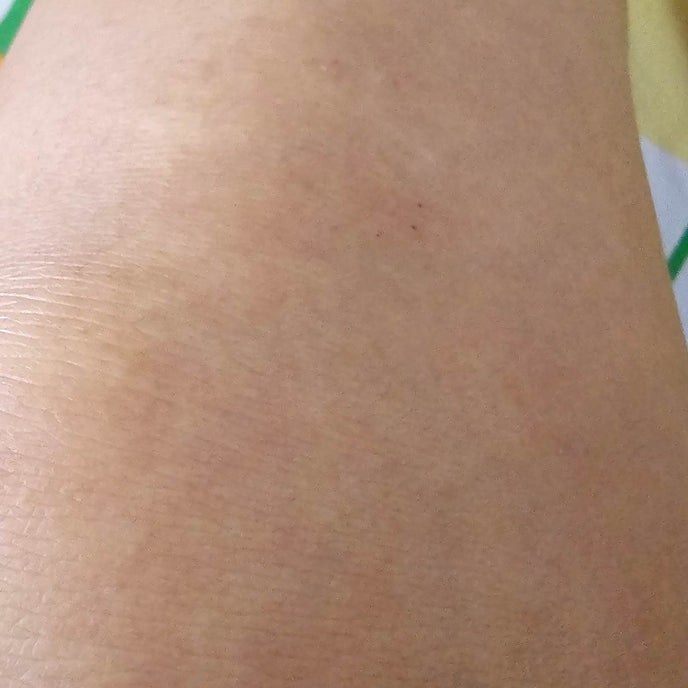 After image