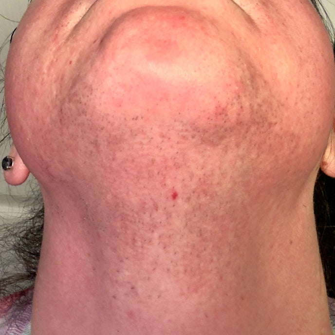 Before image