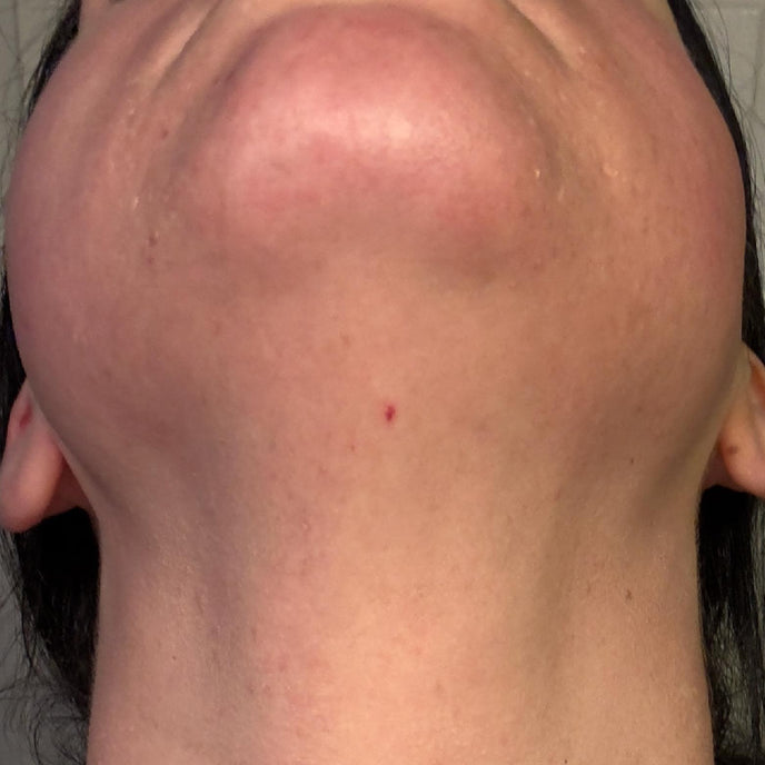 After image