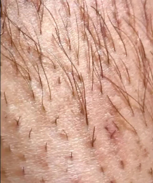 After image