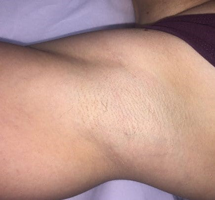 After image