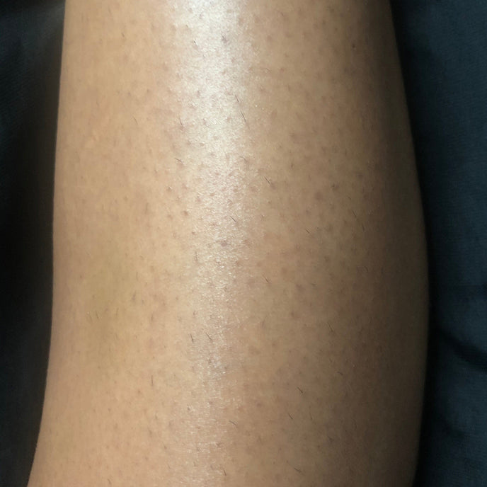 Before image